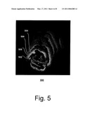 Systems and Methods for Computer-aided Fold Detection diagram and image