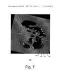 Systems and Methods for Computer-aided Fold Detection diagram and image