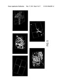 Systems and Methods for Multilevel Nodule Attachment Classification in 3D CT Lung Images diagram and image