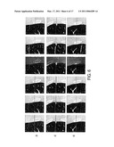 Systems and Methods for Multilevel Nodule Attachment Classification in 3D CT Lung Images diagram and image