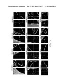 Systems and Methods for Multilevel Nodule Attachment Classification in 3D CT Lung Images diagram and image