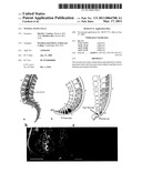 NEURAL STEM CELLS diagram and image