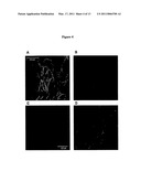 NEURAL STEM CELLS diagram and image