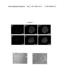 HEMANGIO COLONY FORMING CELLS AND NON-ENGRAFTING HEMANGIO CELLS diagram and image