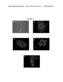 HEMANGIO COLONY FORMING CELLS AND NON-ENGRAFTING HEMANGIO CELLS diagram and image