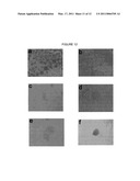 HEMANGIO COLONY FORMING CELLS AND NON-ENGRAFTING HEMANGIO CELLS diagram and image