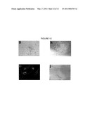 HEMANGIO COLONY FORMING CELLS AND NON-ENGRAFTING HEMANGIO CELLS diagram and image