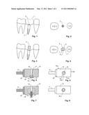 BLANK AND METHOD FOR PRODUCING A DENTAL PROSTHESIS diagram and image