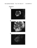 Drug Screening Using Islet Cells and Islet Cell Progenitors from Human Embryonic Stem Cells diagram and image