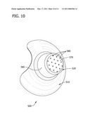 NIPPLE SHIELD diagram and image