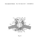 CONSTANT VELOCITY COUPLING diagram and image