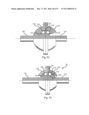 CONSTANT VELOCITY COUPLING diagram and image