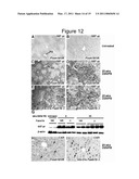 Methods of Inhibiting Tumor Cell Proliferation diagram and image