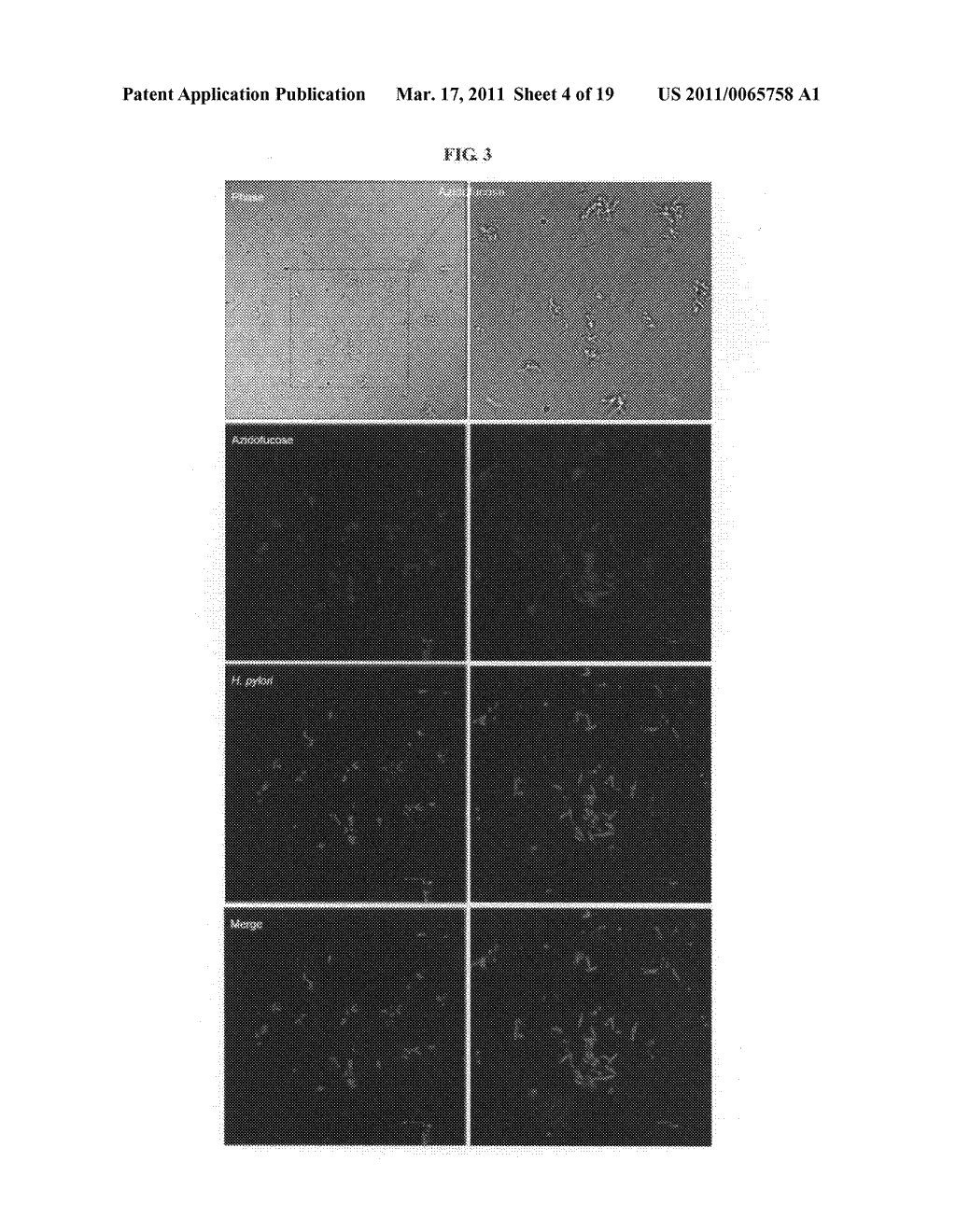 Compositions and assays for treatment and diagnosis of helicobacter pylori infection and conditions - diagram, schematic, and image 05