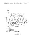 THERMALLY ASSISTED PULSED ELECTRO-MAGNETIC FIELD STIMULATION DEVICE AND METHOD FOR TREATMENT OF OSTEOARTHRITIS diagram and image