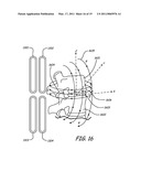 THERMALLY ASSISTED PULSED ELECTRO-MAGNETIC FIELD STIMULATION DEVICE AND METHOD FOR TREATMENT OF OSTEOARTHRITIS diagram and image