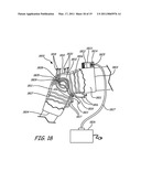 THERMALLY ASSISTED PULSED ELECTRO-MAGNETIC FIELD STIMULATION DEVICE AND METHOD FOR TREATMENT OF OSTEOARTHRITIS diagram and image