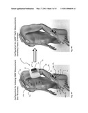 BODY-WORN VITAL SIGN MONITOR diagram and image