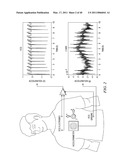 MOTION/ACTIVITY, HEART-RATE AND RESPIRATION FROM A SINGLE CHEST-WORN SENSOR, CIRCUITS, DEVICES, PROCESSES AND SYSTEMS diagram and image