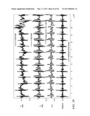 MOTION/ACTIVITY, HEART-RATE AND RESPIRATION FROM A SINGLE CHEST-WORN SENSOR, CIRCUITS, DEVICES, PROCESSES AND SYSTEMS diagram and image