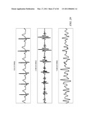 MOTION/ACTIVITY, HEART-RATE AND RESPIRATION FROM A SINGLE CHEST-WORN SENSOR, CIRCUITS, DEVICES, PROCESSES AND SYSTEMS diagram and image