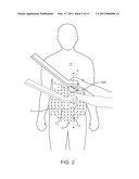 APPARATUS AND METHODS FOR THE DESTRUCTION OF ADIPOSE TISSUE diagram and image