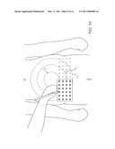 APPARATUS AND METHODS FOR THE DESTRUCTION OF ADIPOSE TISSUE diagram and image