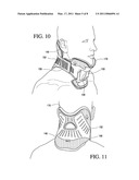 CERVICAL COLLAR WITH REDUCED VASCULAR OBSTRUCTION diagram and image