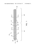 IMPLANTABLE MEDICAL DEVICE HAVING AN ANTI-GASTRIC DISTRESS AGENT diagram and image