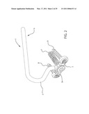 INTERNAL JOINT STABILIZER DEVICE, SYSTEM AND METHOD OF USE diagram and image