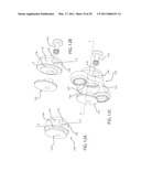 INTERNAL JOINT STABILIZER DEVICE, SYSTEM AND METHOD OF USE diagram and image