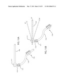 INTERNAL JOINT STABILIZER DEVICE, SYSTEM AND METHOD OF USE diagram and image