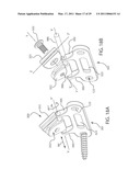 INTERNAL JOINT STABILIZER DEVICE, SYSTEM AND METHOD OF USE diagram and image