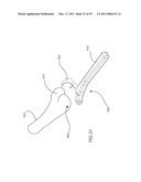 INTERNAL JOINT STABILIZER DEVICE, SYSTEM AND METHOD OF USE diagram and image