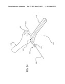 INTERNAL JOINT STABILIZER DEVICE, SYSTEM AND METHOD OF USE diagram and image