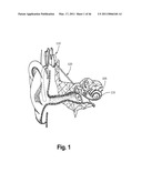 SYSTEMS AND METHODS FOR INSERTING STEERABLE ARRAYS INTO ANATOMICAL STRUCTURES diagram and image