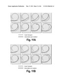 SYSTEMS AND METHODS FOR INSERTING STEERABLE ARRAYS INTO ANATOMICAL STRUCTURES diagram and image