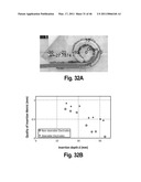 SYSTEMS AND METHODS FOR INSERTING STEERABLE ARRAYS INTO ANATOMICAL STRUCTURES diagram and image