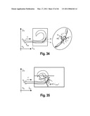 SYSTEMS AND METHODS FOR INSERTING STEERABLE ARRAYS INTO ANATOMICAL STRUCTURES diagram and image