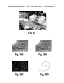 SYSTEMS AND METHODS FOR INSERTING STEERABLE ARRAYS INTO ANATOMICAL STRUCTURES diagram and image