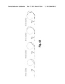 SYSTEMS AND METHODS FOR INSERTING STEERABLE ARRAYS INTO ANATOMICAL STRUCTURES diagram and image