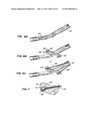 ARTICULATING SUTURING DEVICE AND METHOD diagram and image