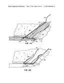 ARTICULATING SUTURING DEVICE AND METHOD diagram and image