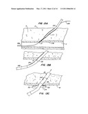 ARTICULATING SUTURING DEVICE AND METHOD diagram and image