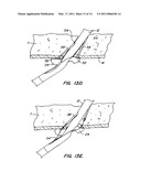 ARTICULATING SUTURING DEVICE AND METHOD diagram and image