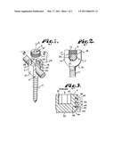 Threadform for medical implant closure diagram and image