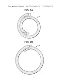 Expandable Ring Intervertebral Fusion Device diagram and image