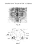 Surgical Tools for Arthroplasty diagram and image