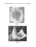 Surgical Tools for Arthroplasty diagram and image