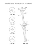 Surgical Tools for Arthroplasty diagram and image